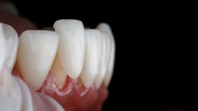 Dental Crown Treatment 